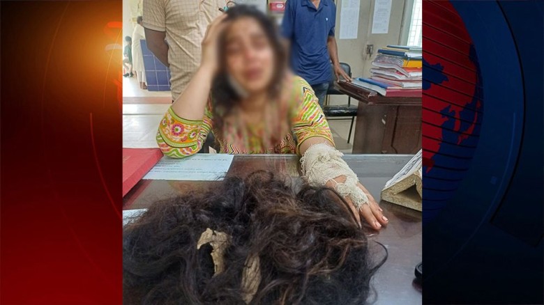 আখাউড়ায় যৌতুকের টাকা না পেয়ে স্ত্রীর চুল কেটে পালা...